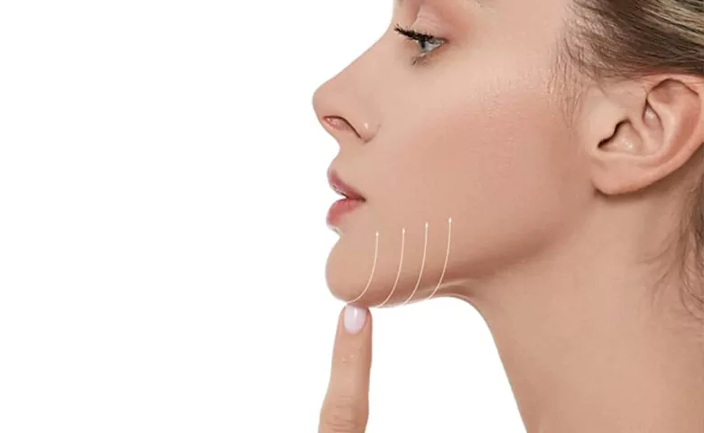 مزایای بینظیر تزریق مزوژل برای غبغب